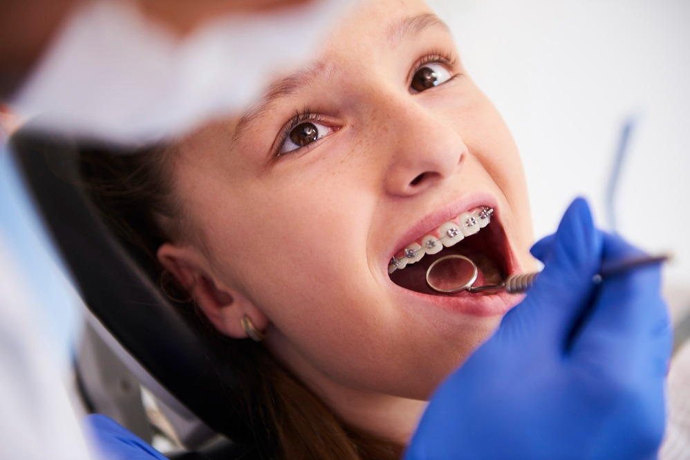 Orthodontic treatment in Delhi – Why timing matters main image