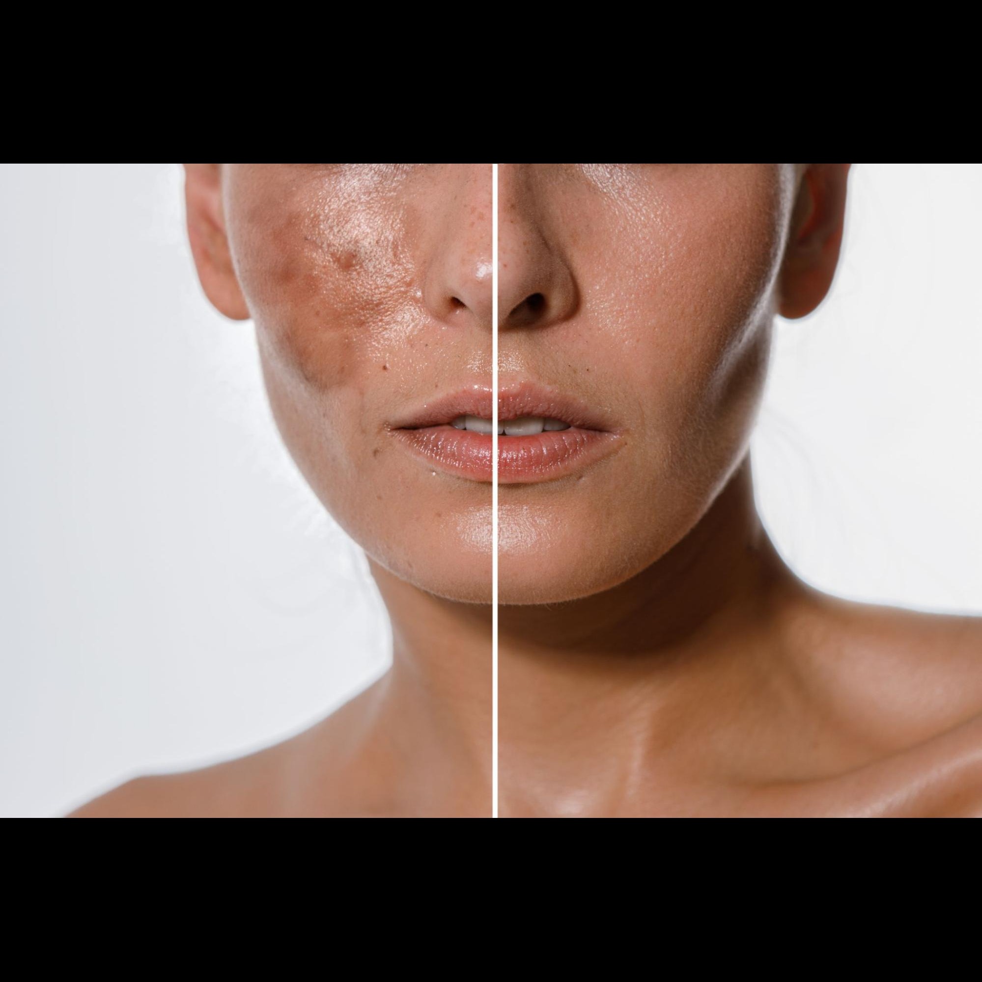 Aesthetic Treatment Near me In Salem main image