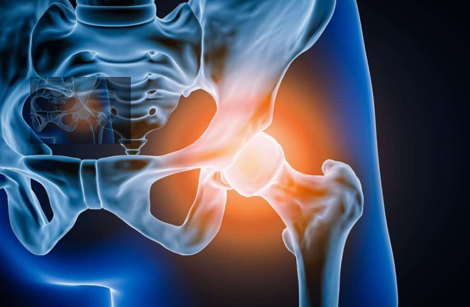Bone Health and Fracture Care in Chennai main image