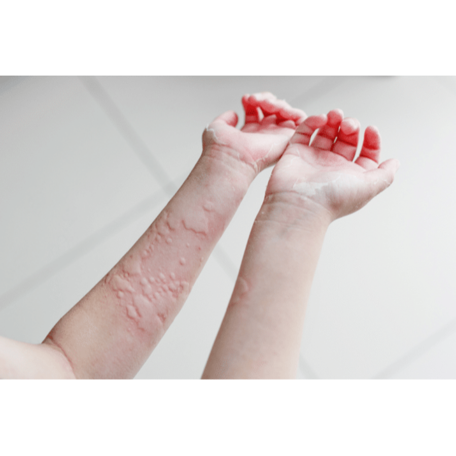 Skin Clinic Near Me In Salem main image