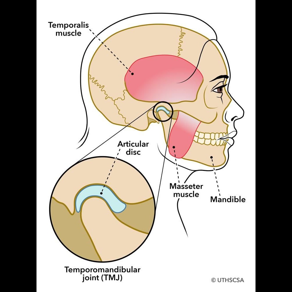 TMJoint