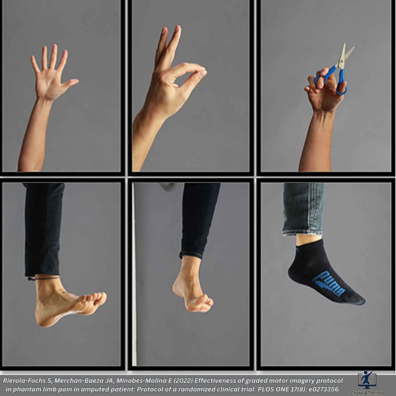 🧠 Graded Motor Imagery: Retraining the Brain for Pain and Movement  Graded Motor Imagery (GMI) is a... main image
