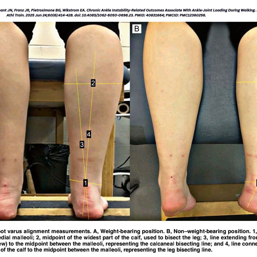 Chronic Ankle Instability–Related Outcomes Associate With Ankle-Joint Loading During Walking main image
