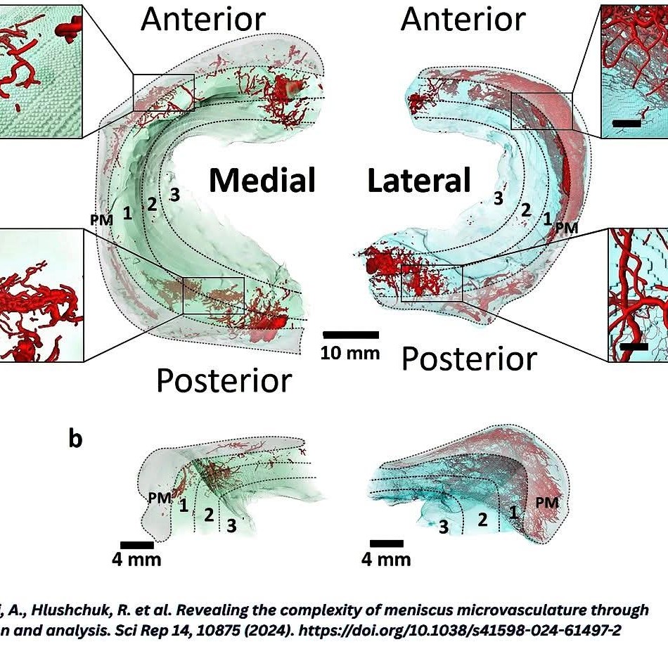 Revealing the complexity of meniscus microvasculature through 3D visualization and analysis main image