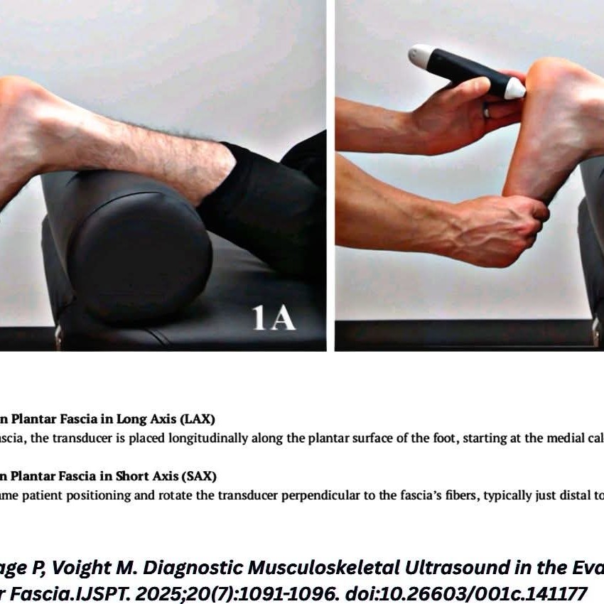 Diagnostic Musculoskeletal Ultrasound in the Evaluation of the Plantar Fascia main image