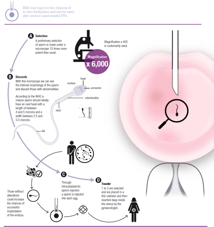 What is IVF Treatment | 100% Best Services main image