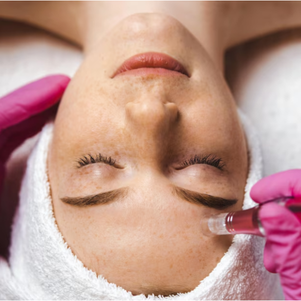 Acne Scar and Microneedling Treatment in Nashik for Clearer Skin main image