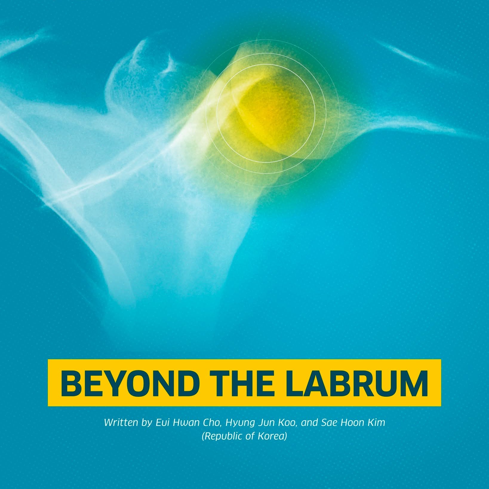 Beyond The Labrum
Anterior Shoulder Stability In Elite Athletes main image