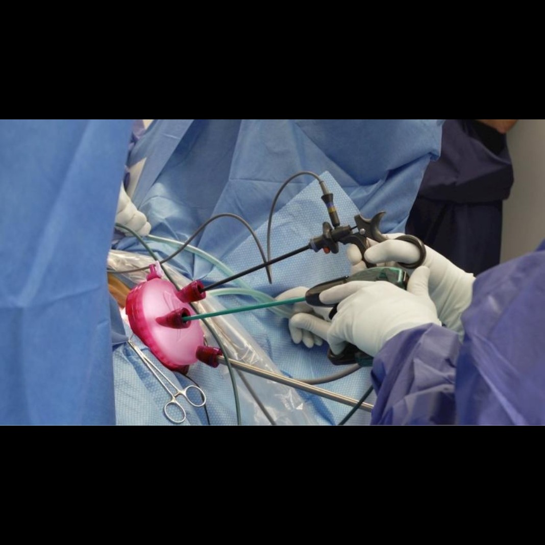 Minimally Invasive Gynecologic Surgery: All You Need to Know main image