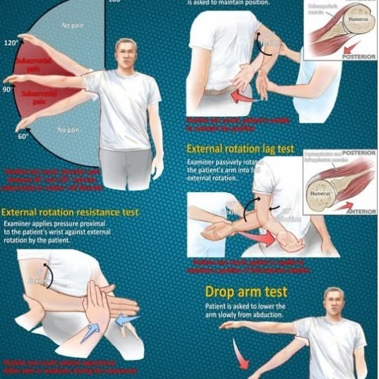 Frozen Shoulder treatment at Sunshine Clinic main image