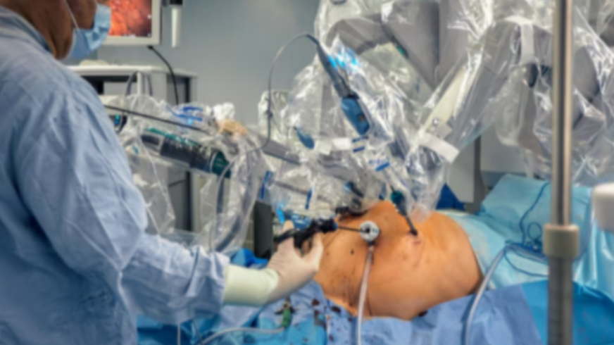 Robotic Cholecystectomy for Gall Stone in Dasarahalli main image