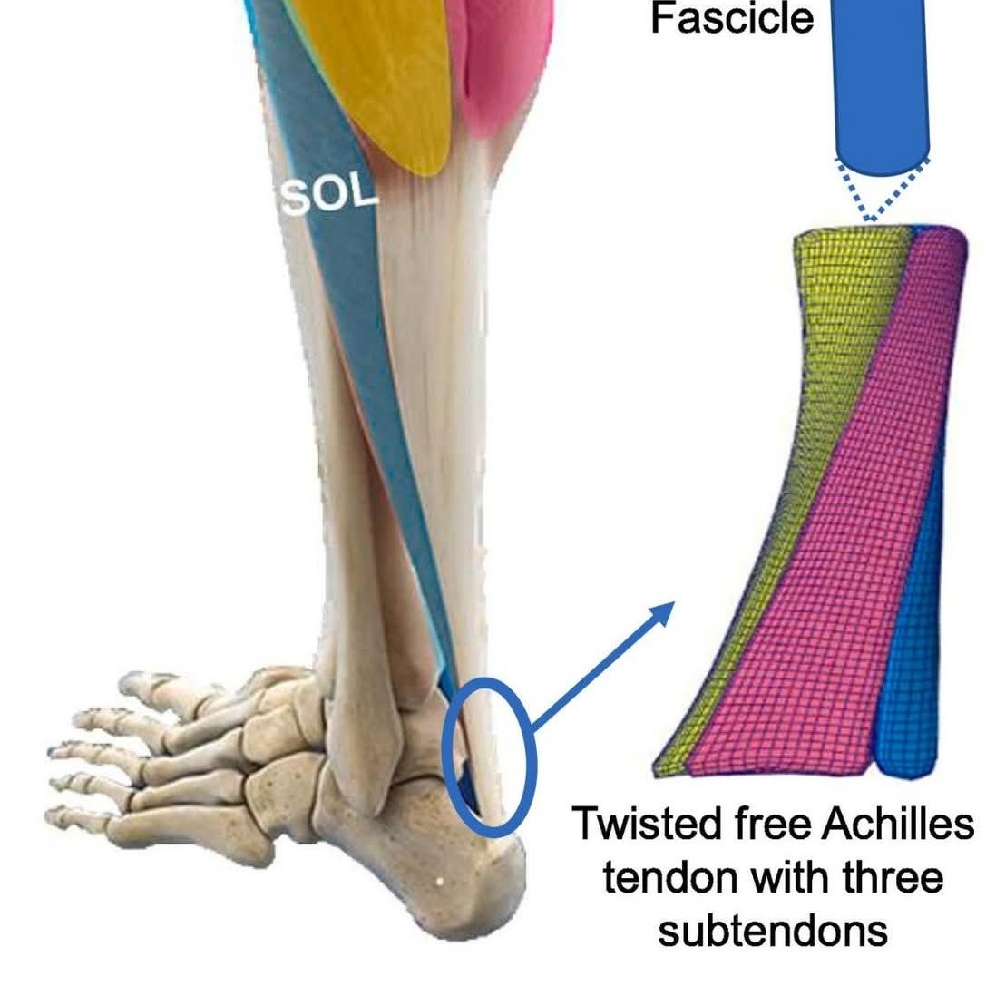 Achilles tendon Strain Treatment at Sunshine Clinic main image