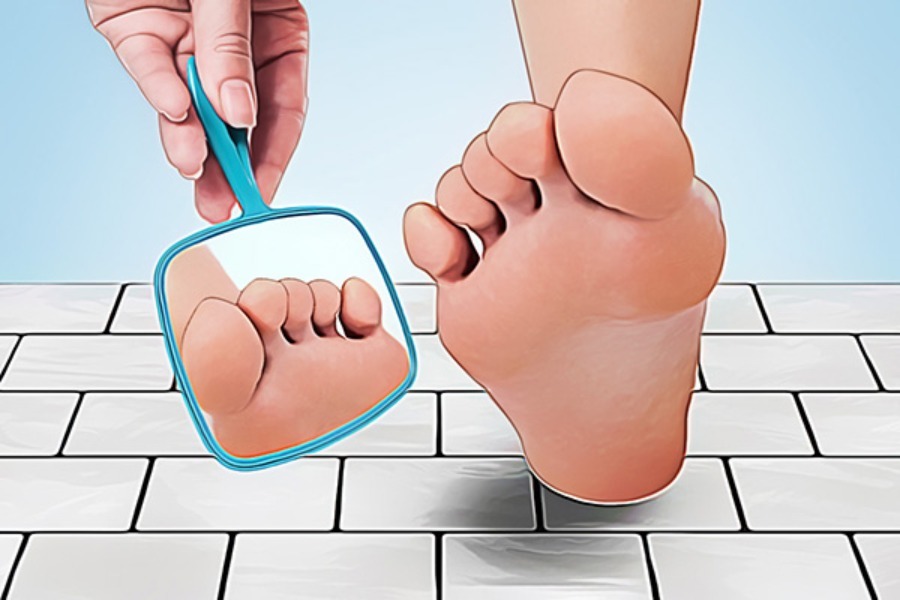Diabetic Foot Care in Bangalore – Protecting Every Step You Take main image