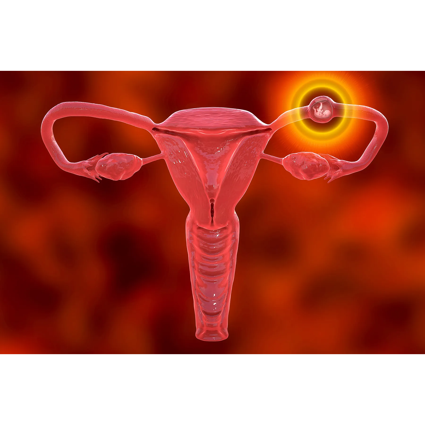 What Is an Ectopic Pregnancy? main image