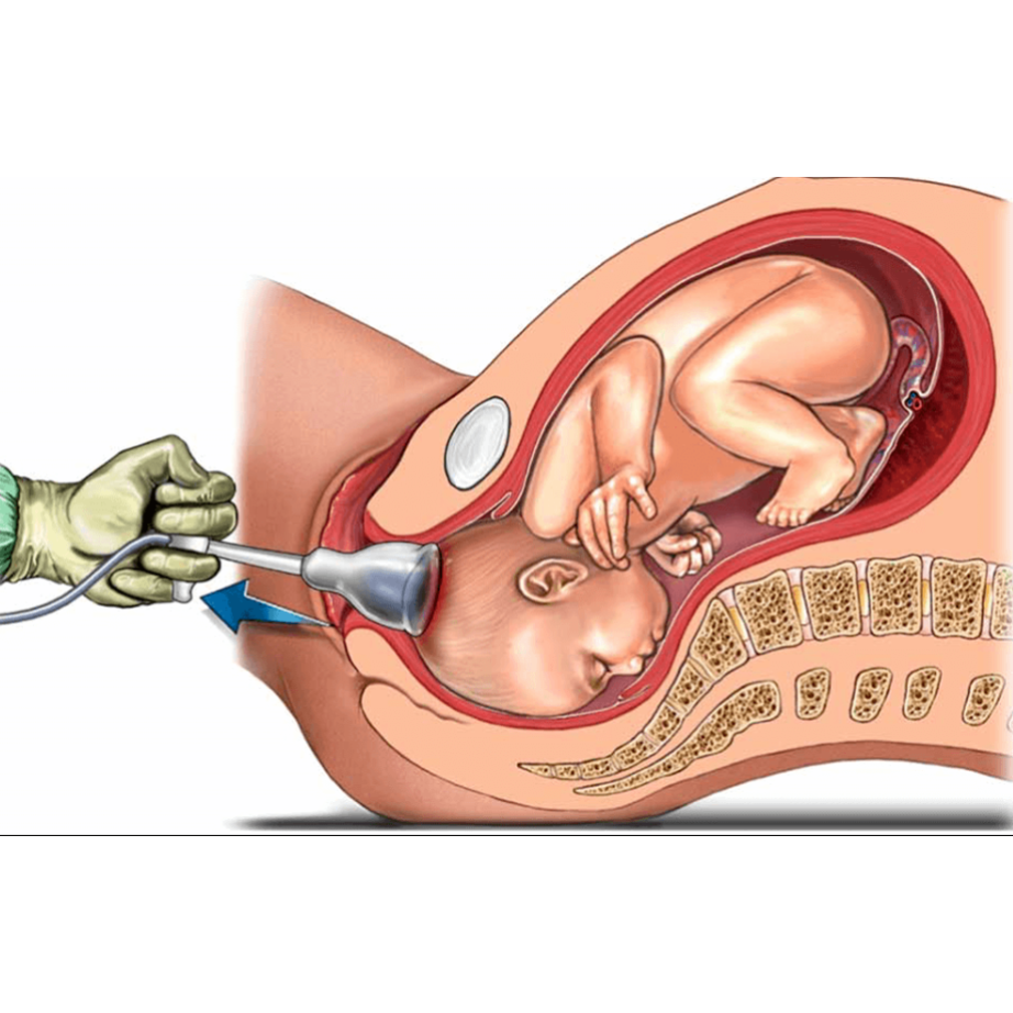 Assisted Delivery in Nagpur main image