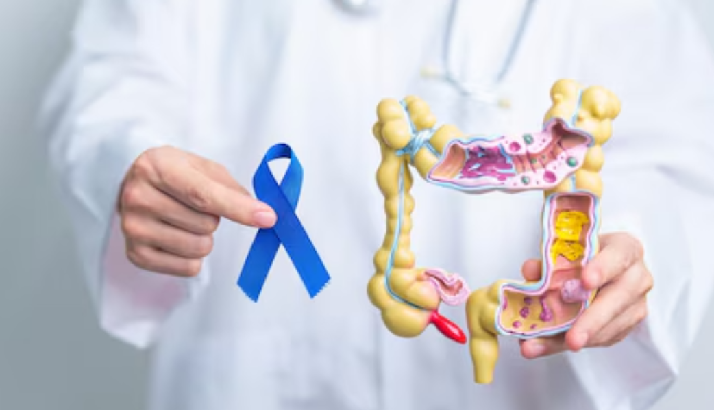 Robotic Rectal Cancer Surgery in Nelamangala for Safer Outcomes main image