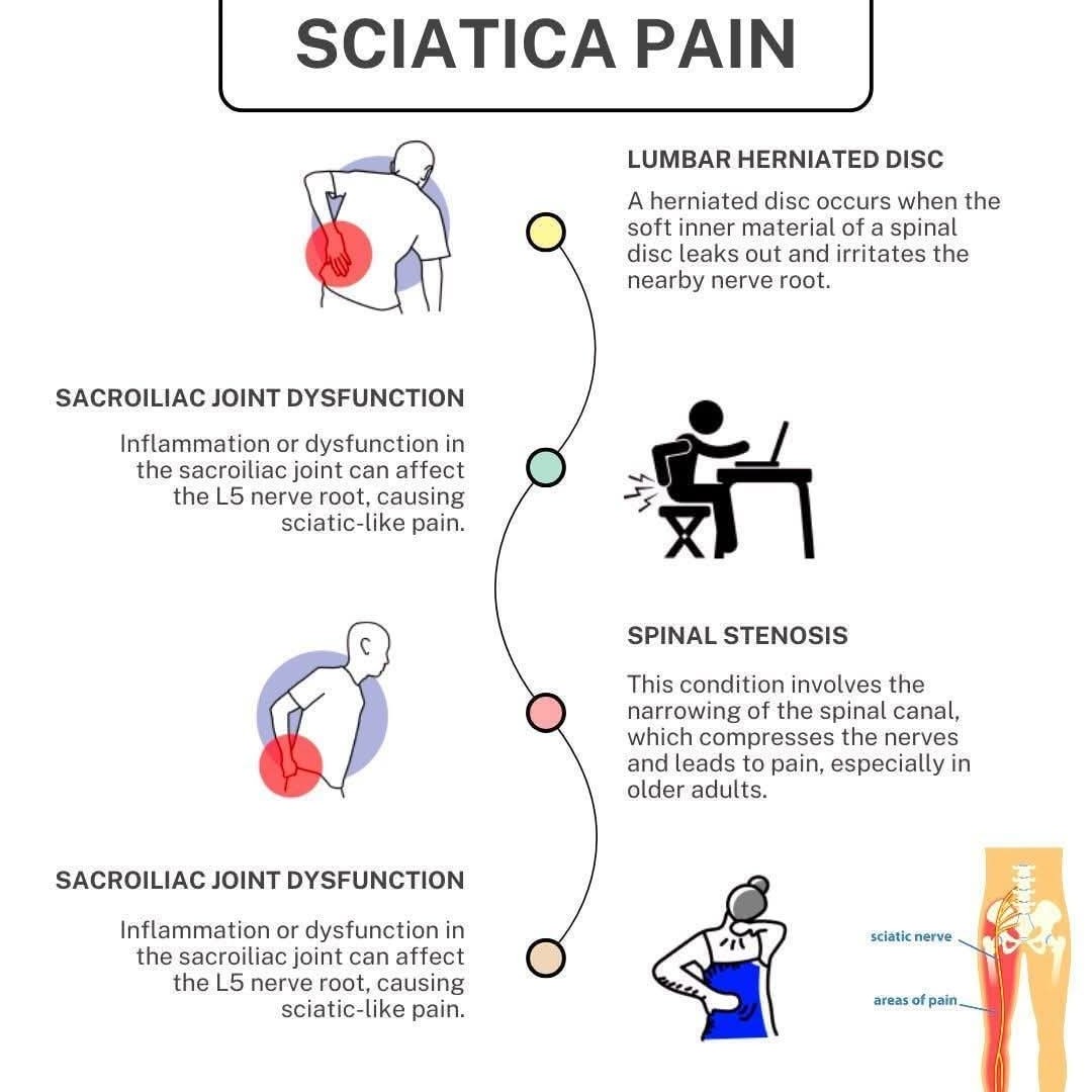 Causes of Sciatica and Physiotherapy Treatment at Sunshine Super Speciality Physiotherapy Clinic main image