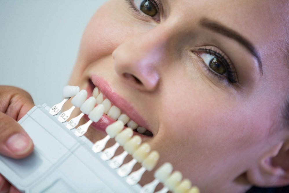 Veneers and Laminates in Nashik for a Flawless Smile main image