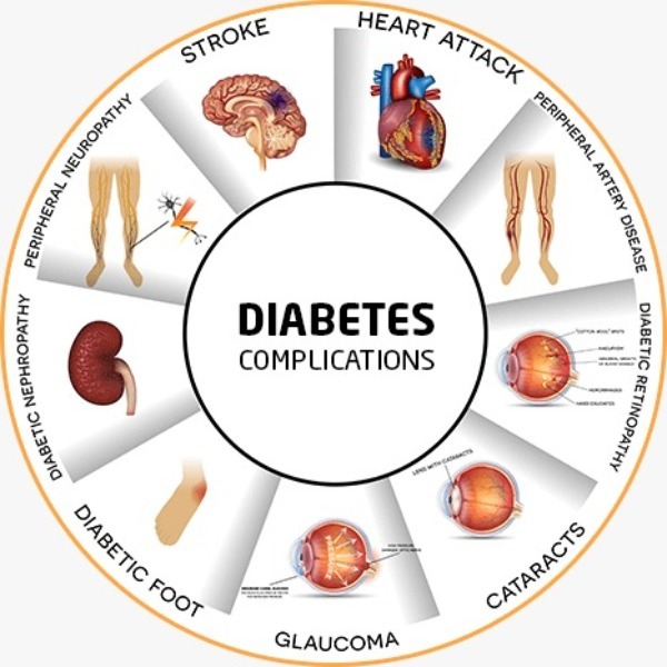 🩺 Diabetes Complications — Stay Alert, Stay Healthy

Uncontrolled diabetes can affect multiple orga... main image