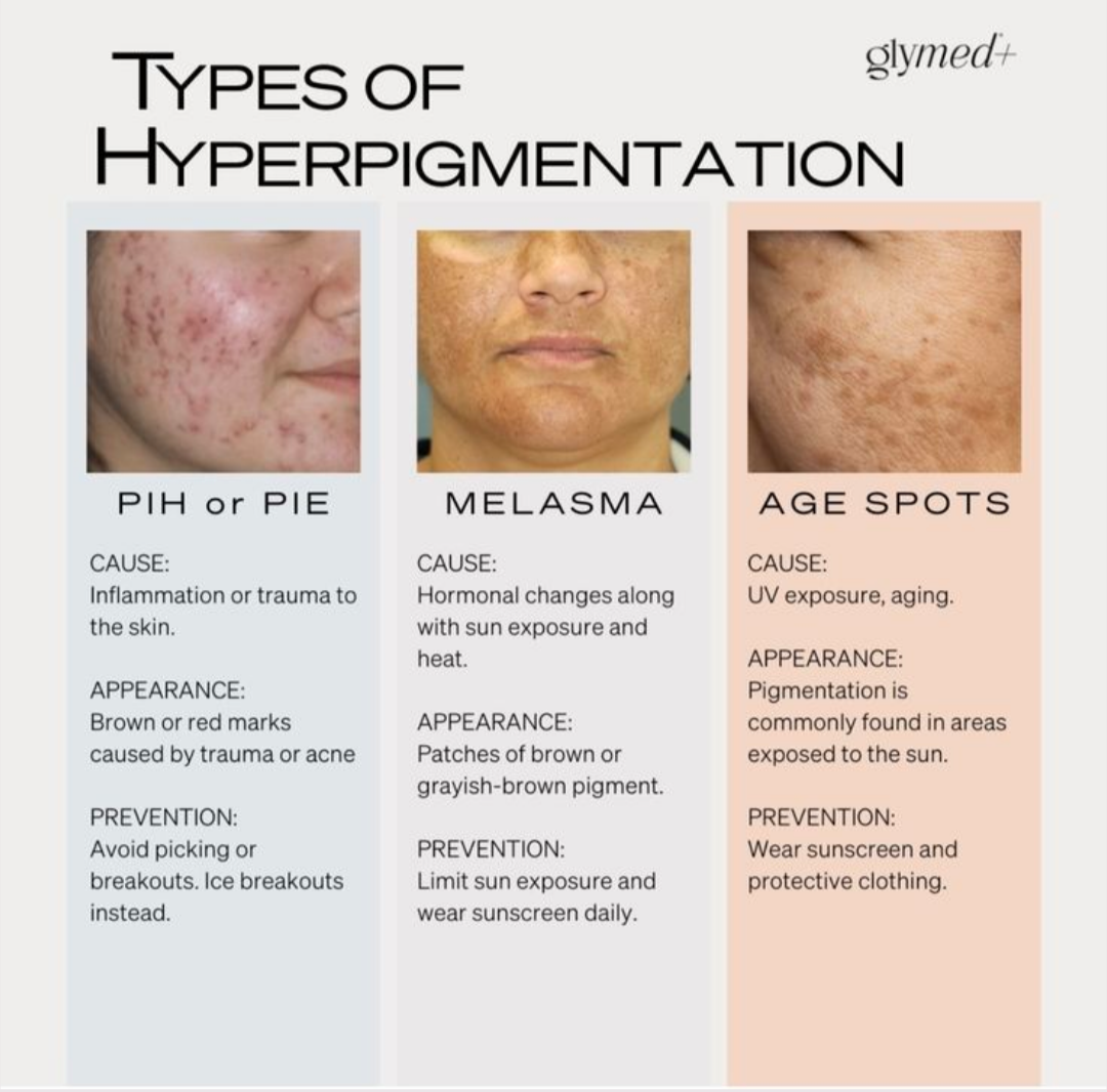 Best and affordable Hyperpigmentation treatment clinic in nasik is Mauli skin-Hair-Laser clinic.   W... main image