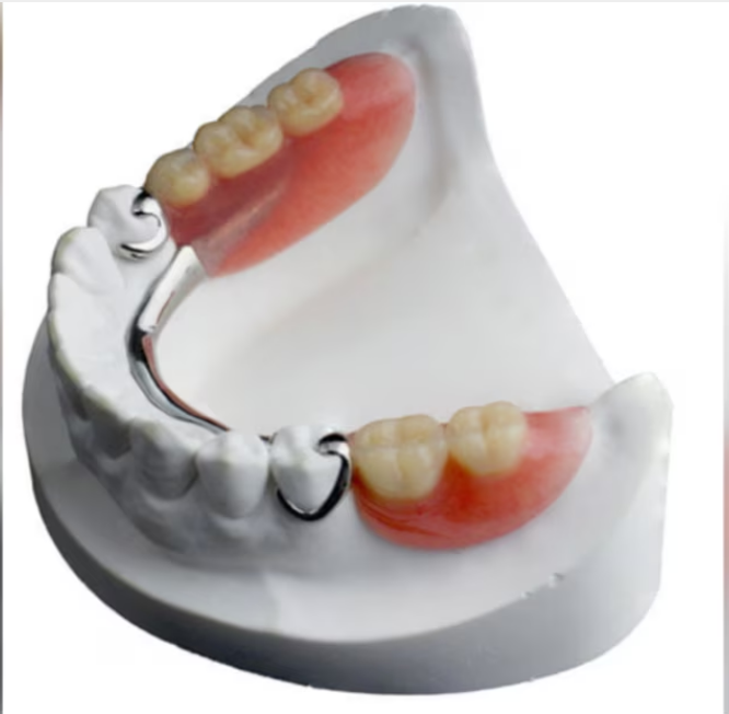 Cast Partial Dentures Clinic In Janakpuri main image
