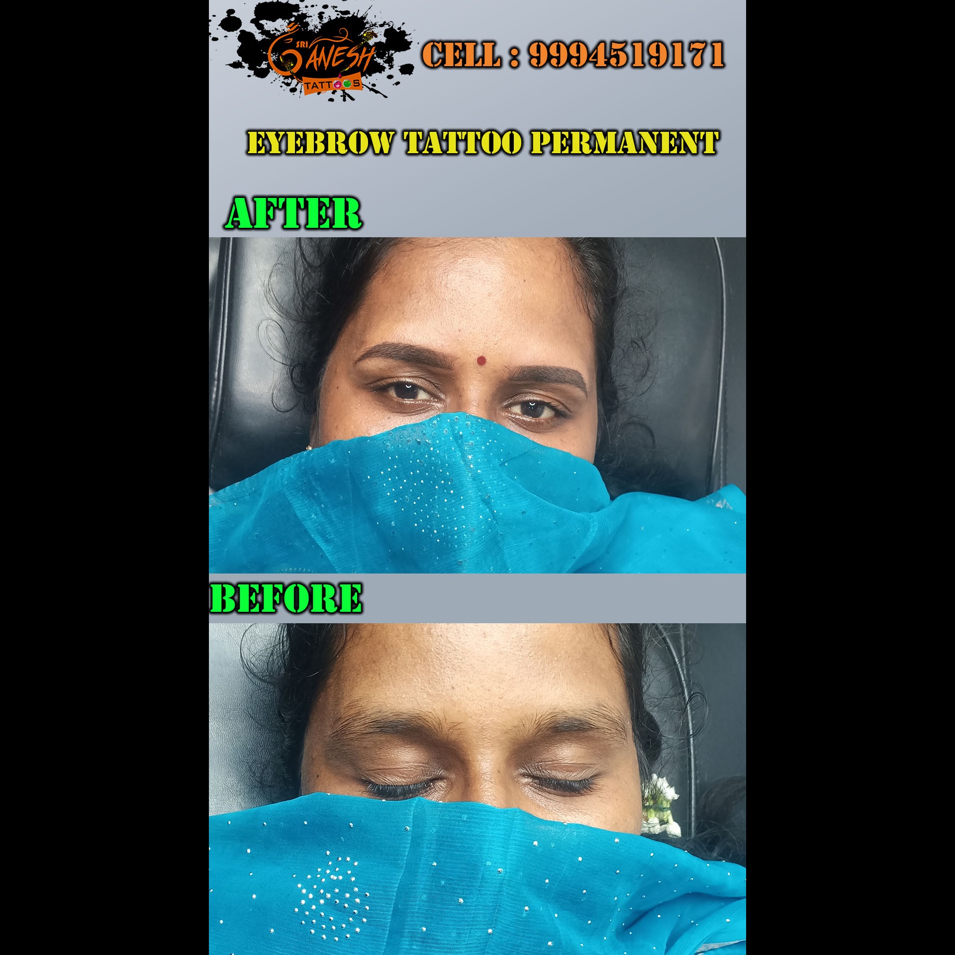 Image Blog