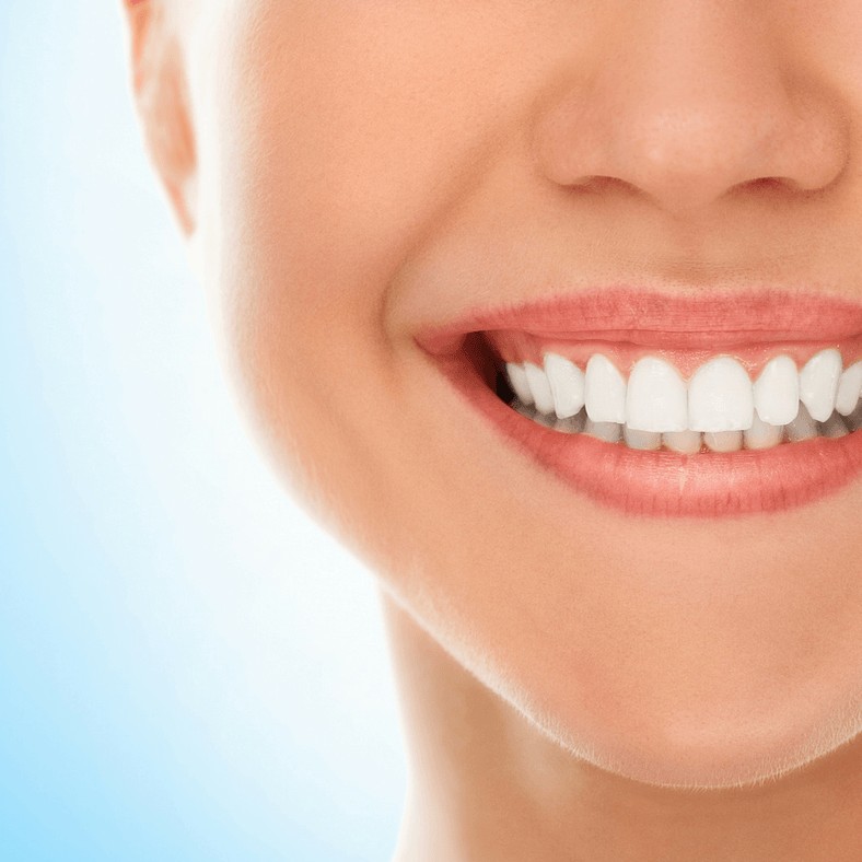 Teeth Whitening in Bandra, Mahim & Dadar – Get a Brighter Smile Today! main image