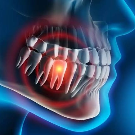 Why Is My Tooth Hurting? Common Causes & Effective Treatments main image