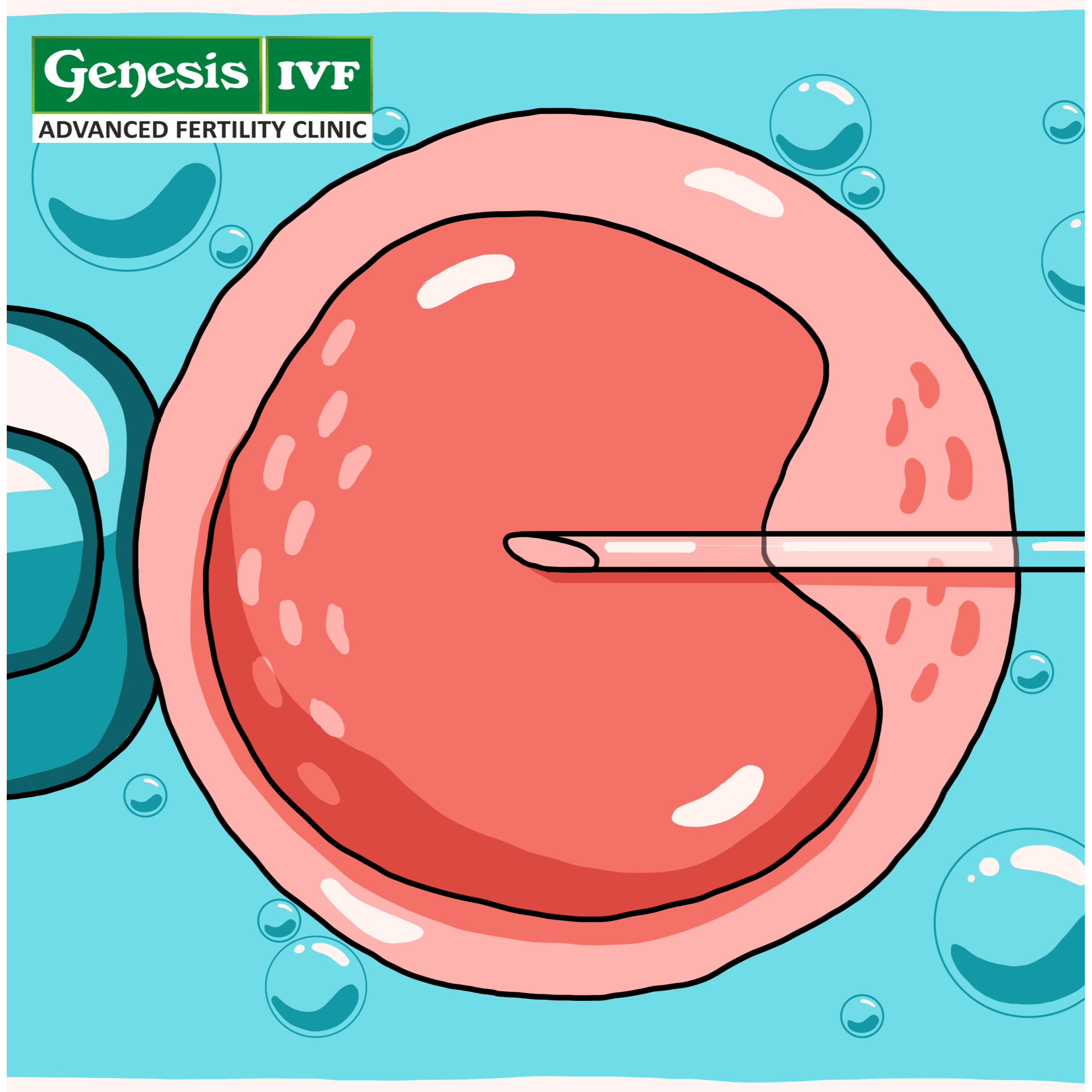 How Many Eggs Are Needed for a Successful IVF Cycle? Understanding the Ideal Count main image