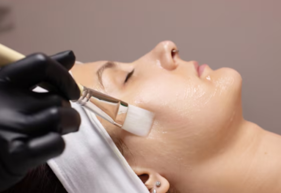 Chemical Peel Cost for Face in Chennai – Discover Safe and Effective Skin Rejuvenation main image