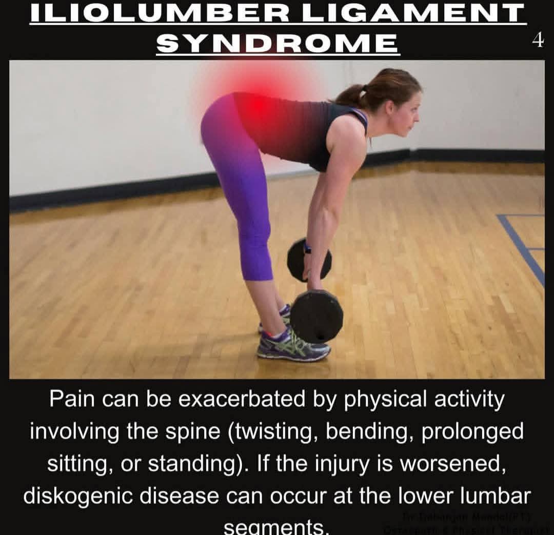 Illiolumber Syndrome
Iliolumbar ligament syndrome, also known as iliac crest pain syndrome treatment main image