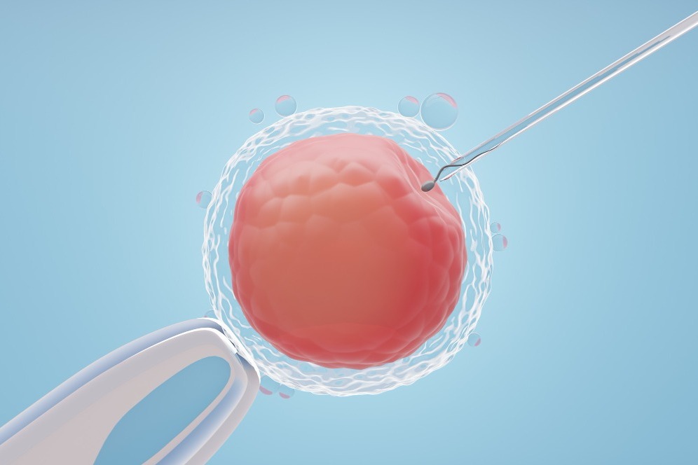 Best IVF Specialist in Chennai – Expertise That Shapes Successful Outcomes main image