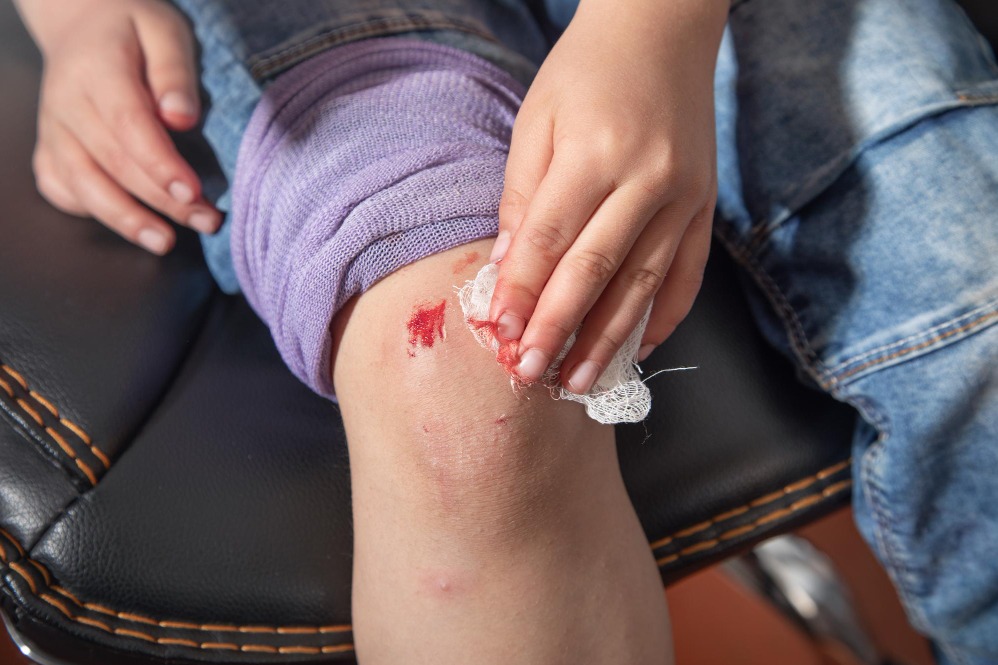 Non healing wound in Bangalore – Stopping a Small Problem from Becoming Bigger main image