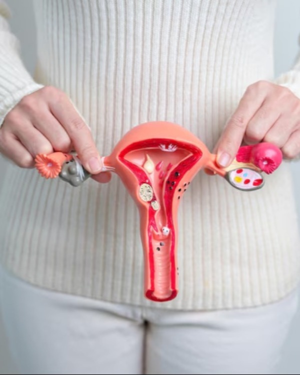 PCOS Treatment in Chennai – Restoring Hormonal Balance and Fertility main image