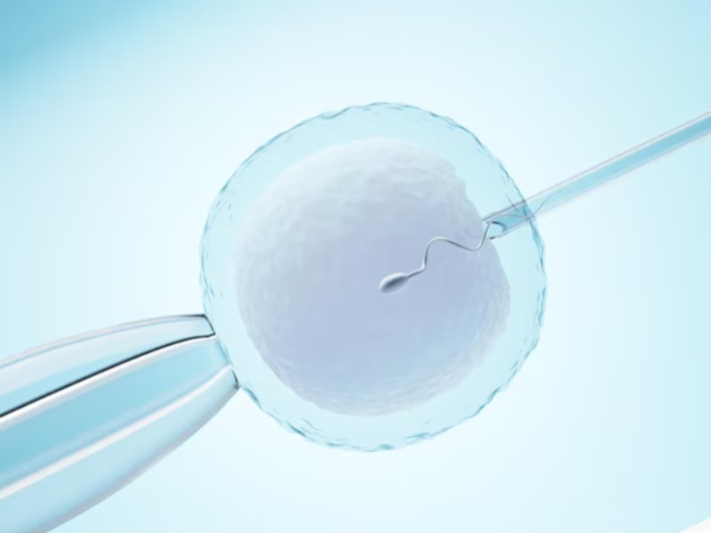 Best IVF Hospital in Chennai – Advanced Treatments for High Success Rates main image