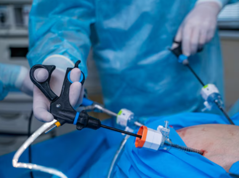 Laparoscopic Surgeon in Kalyan East – Faster Recovery, Better Comfort main image