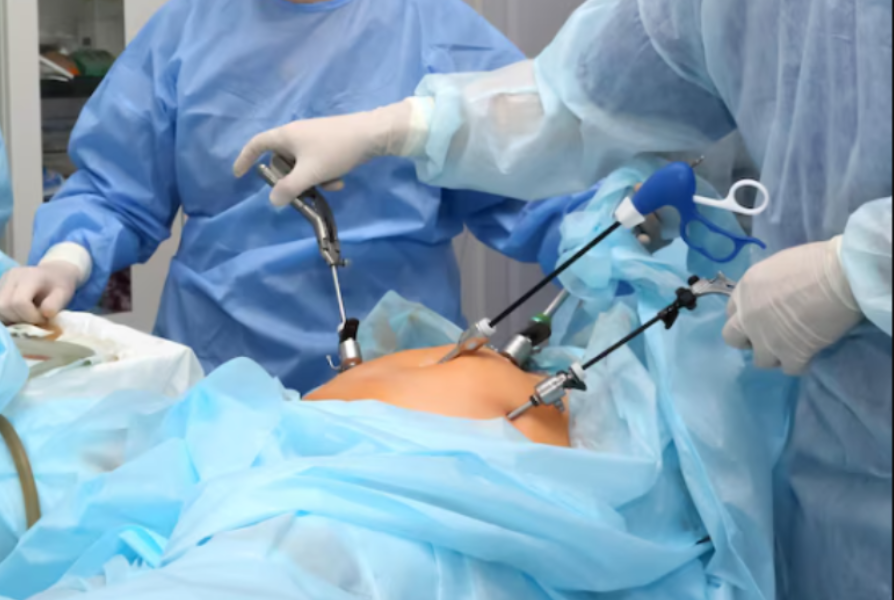 Laparoscopic Hysterectomy in Chennai main image