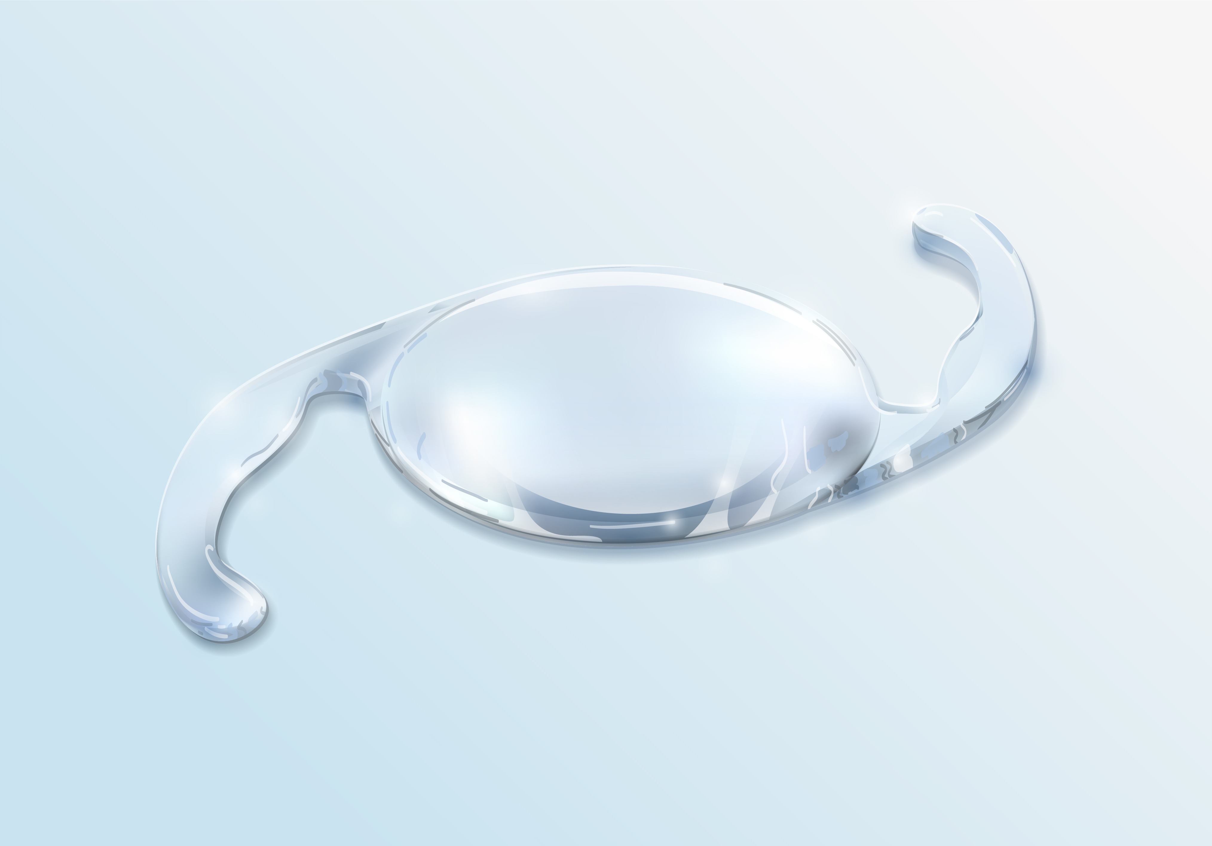 Toric IOL in Nagpur for Astigmatism Correction During Cataract Surgery main image