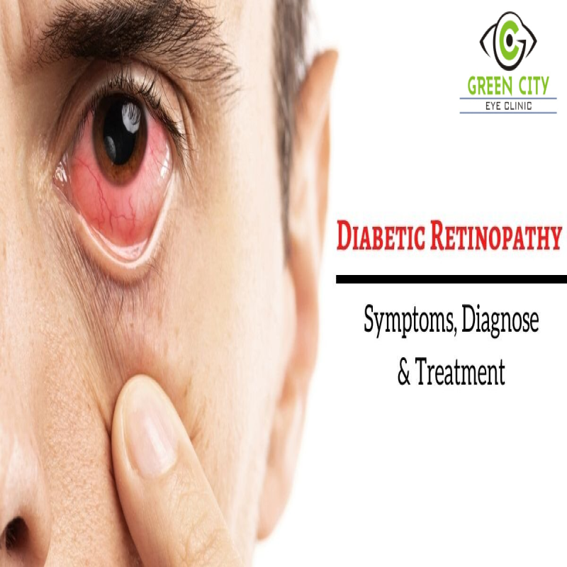 Diabetic Retinopathy Care in Nagpur main image
