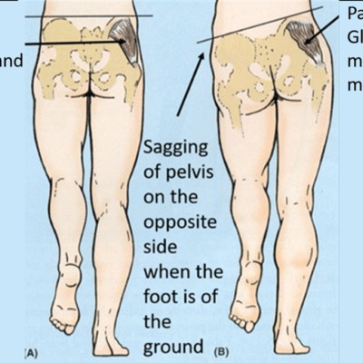Geriatric Physiotherapy Home Visit Service – Sunshine Super Speciality Physiotherapy Clinic main image