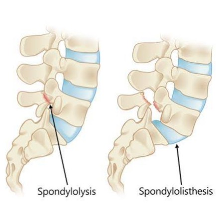 Low Back Pain treatment at Sunshine Clinic main image