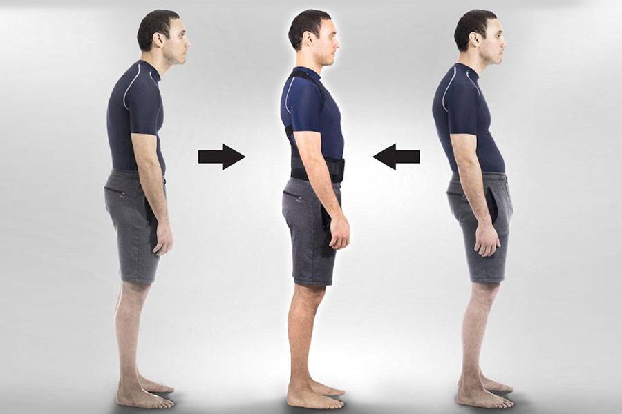 Posture Correction & Spine Care Physiotherapy near me main image