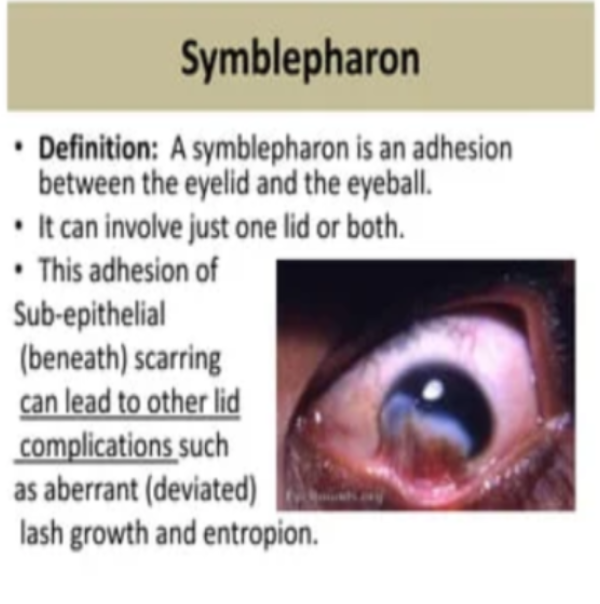 Symblepharon Treatment in Nagpur main image