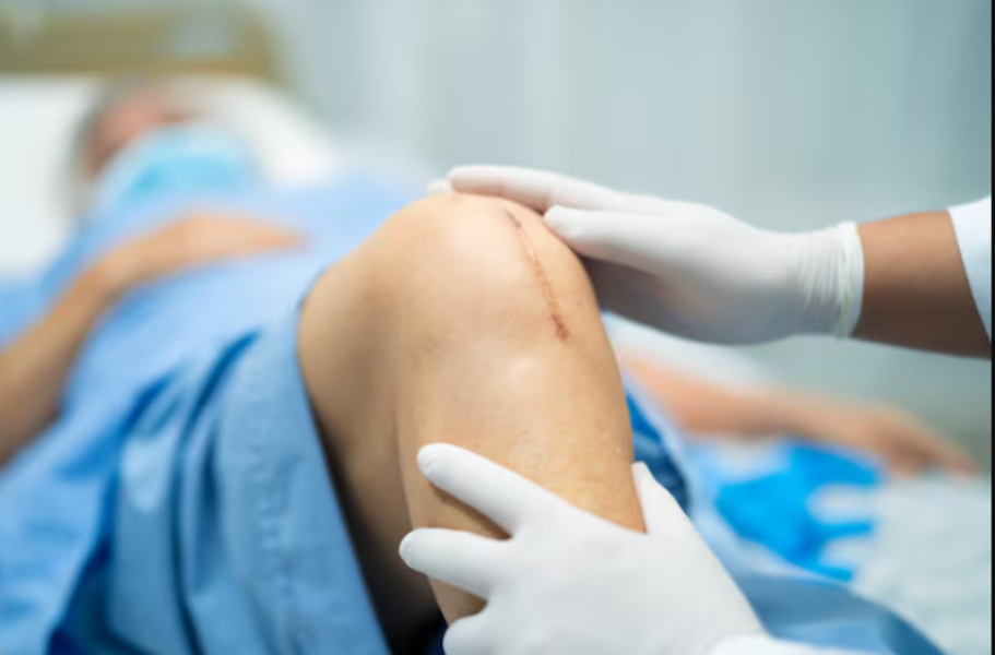 Total Joint Replacement in Chennai main image