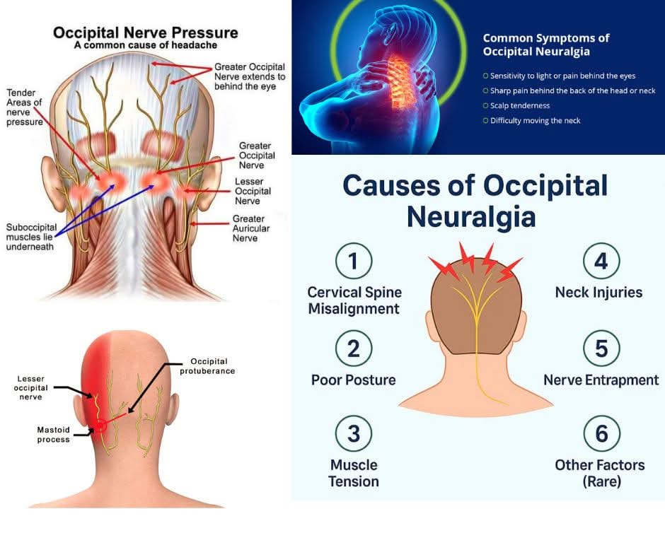 Occipital Nerve Pressure treatment at Sunshine Super Speciality Physiotherapy Clinic main image