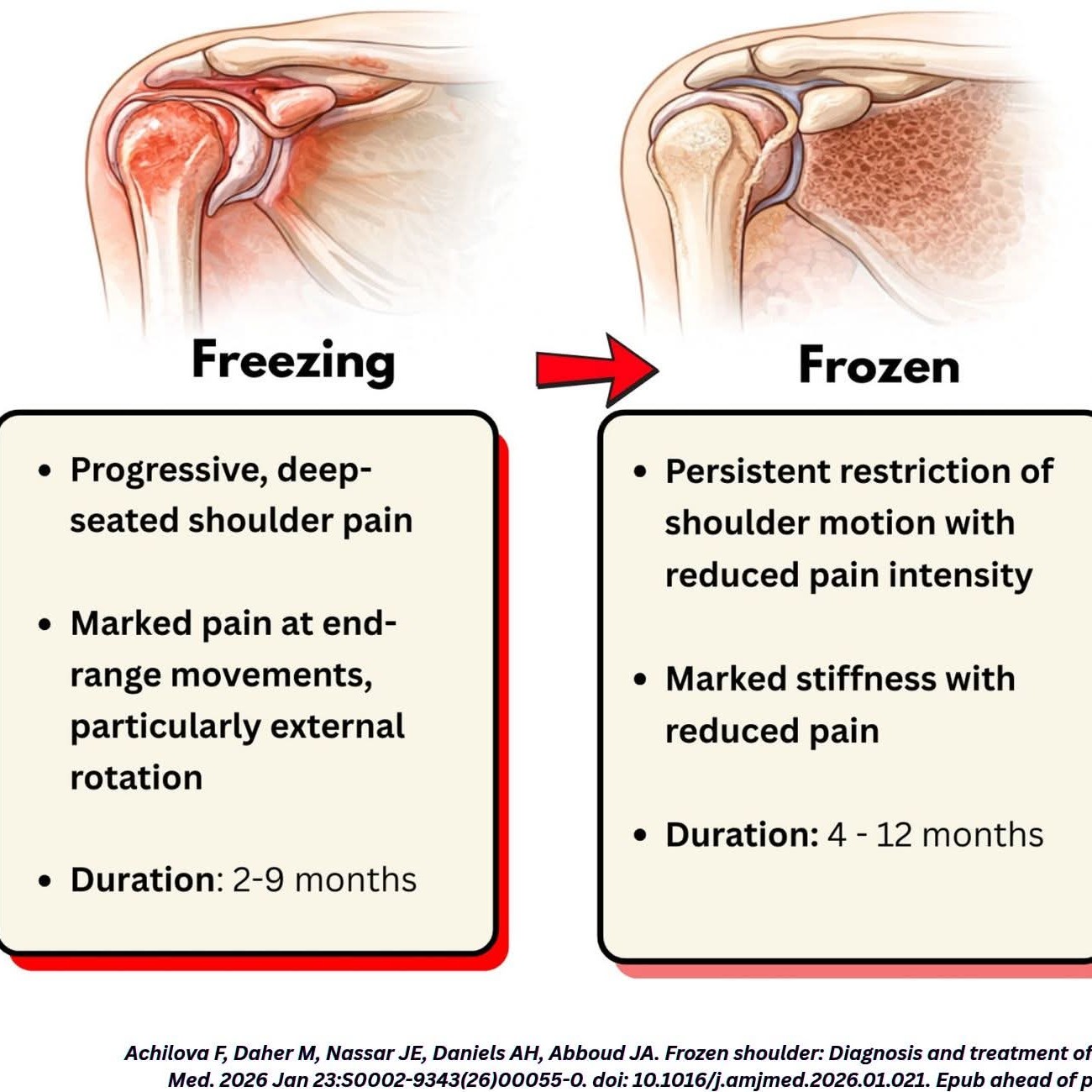 Frozen shoulder treatment at Sunshine Super Speciality Physiotherapy Clinic main image