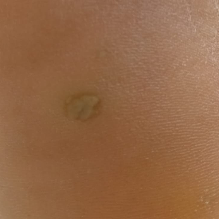 Vibha skin