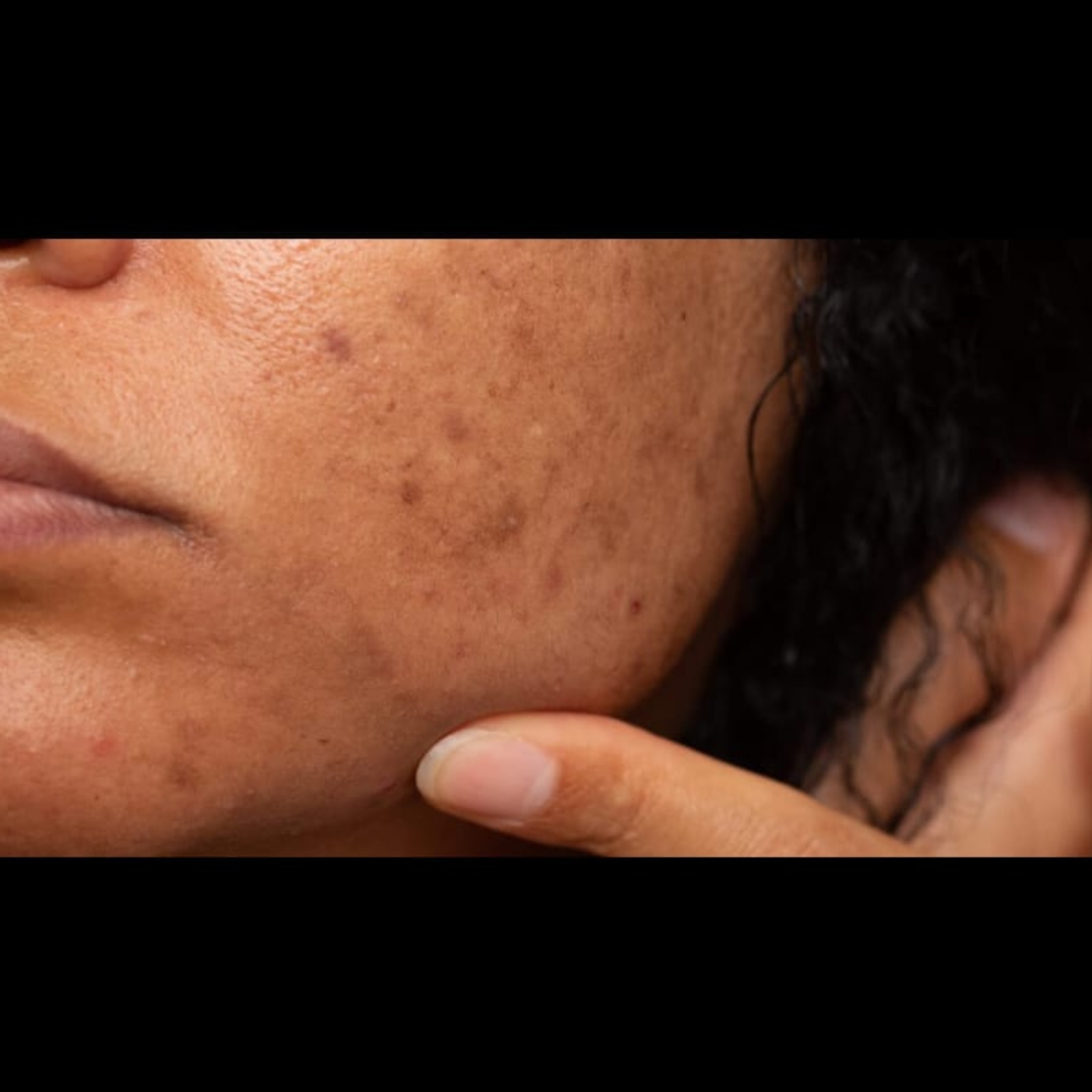 Skin Care Clinic Near Me In Salem main image