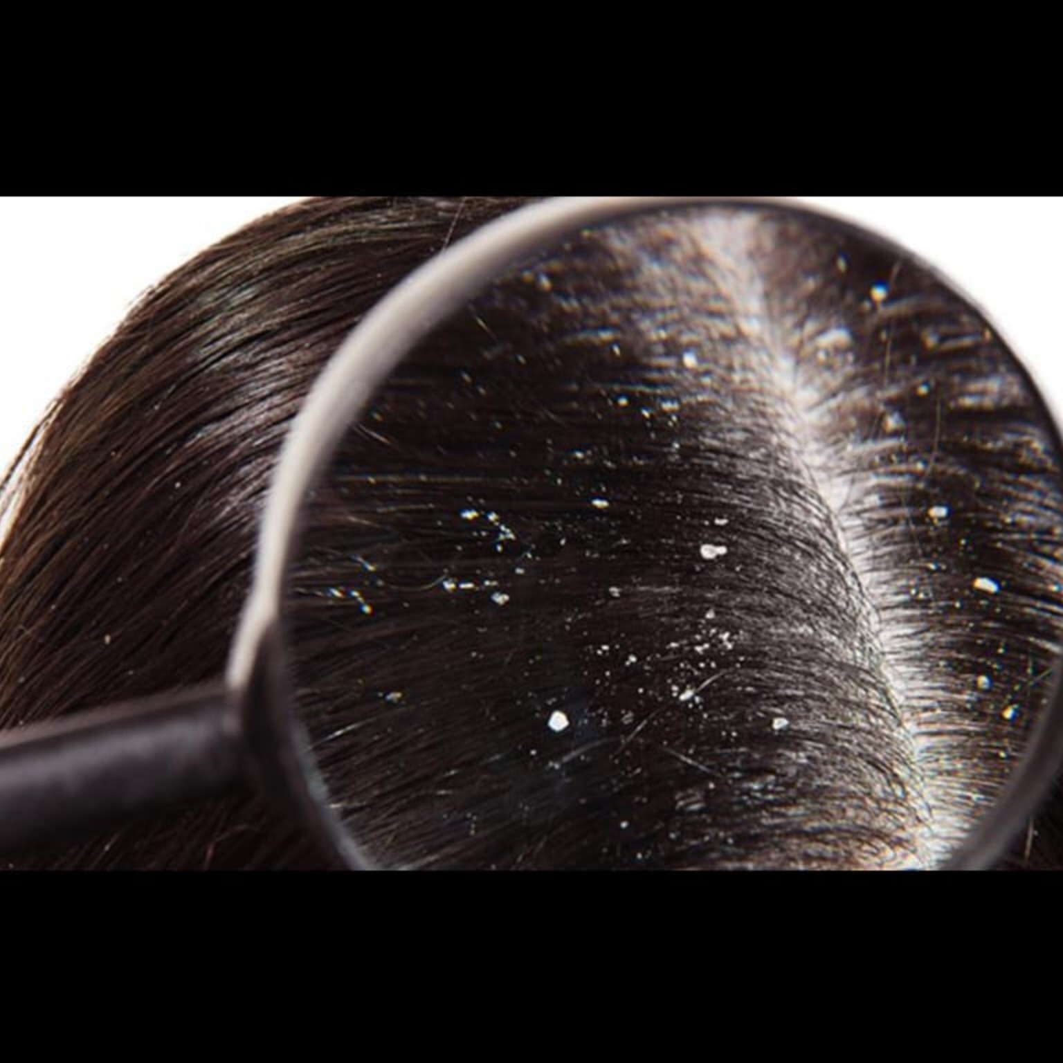 Hair Care Hospital Near Me In Salem Seelanaickenpatti main image