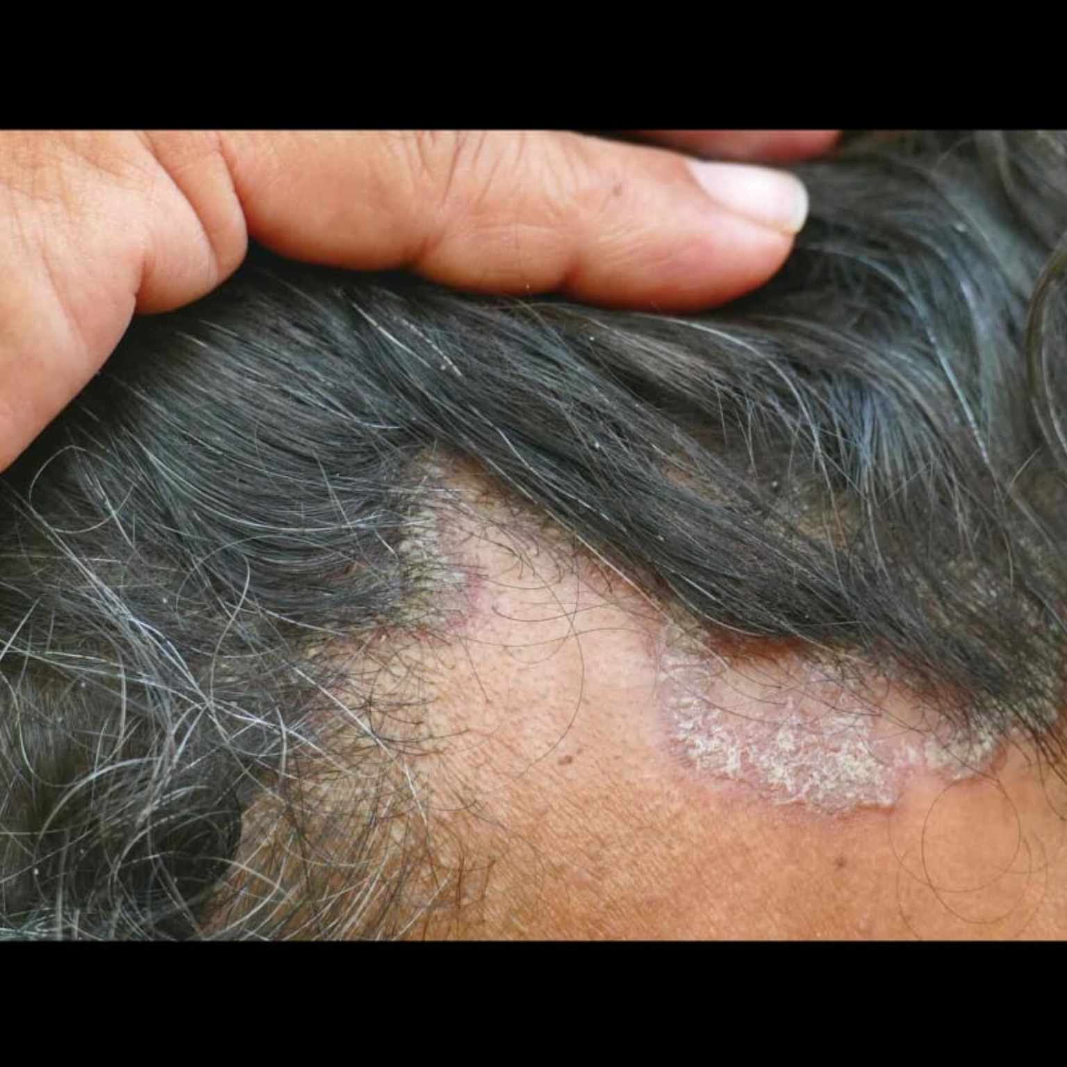 Hair Care Doctor Near Me In Salem main image